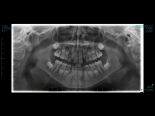 four cycles of new teeth growth